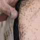 immediate bed bug treatment NYC